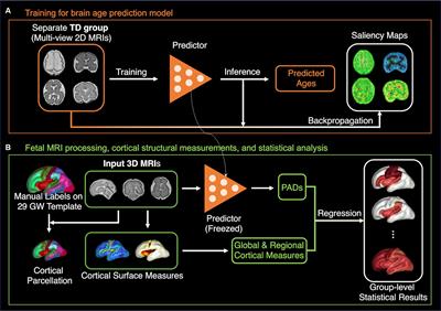 The role of cortical structural variance in deep learning-based prediction of fetal brain age